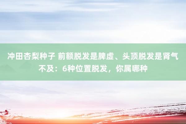 冲田杏梨种子 前额脱发是脾虚、头顶脱发是肾气不及：6种位置脱发，你属哪种